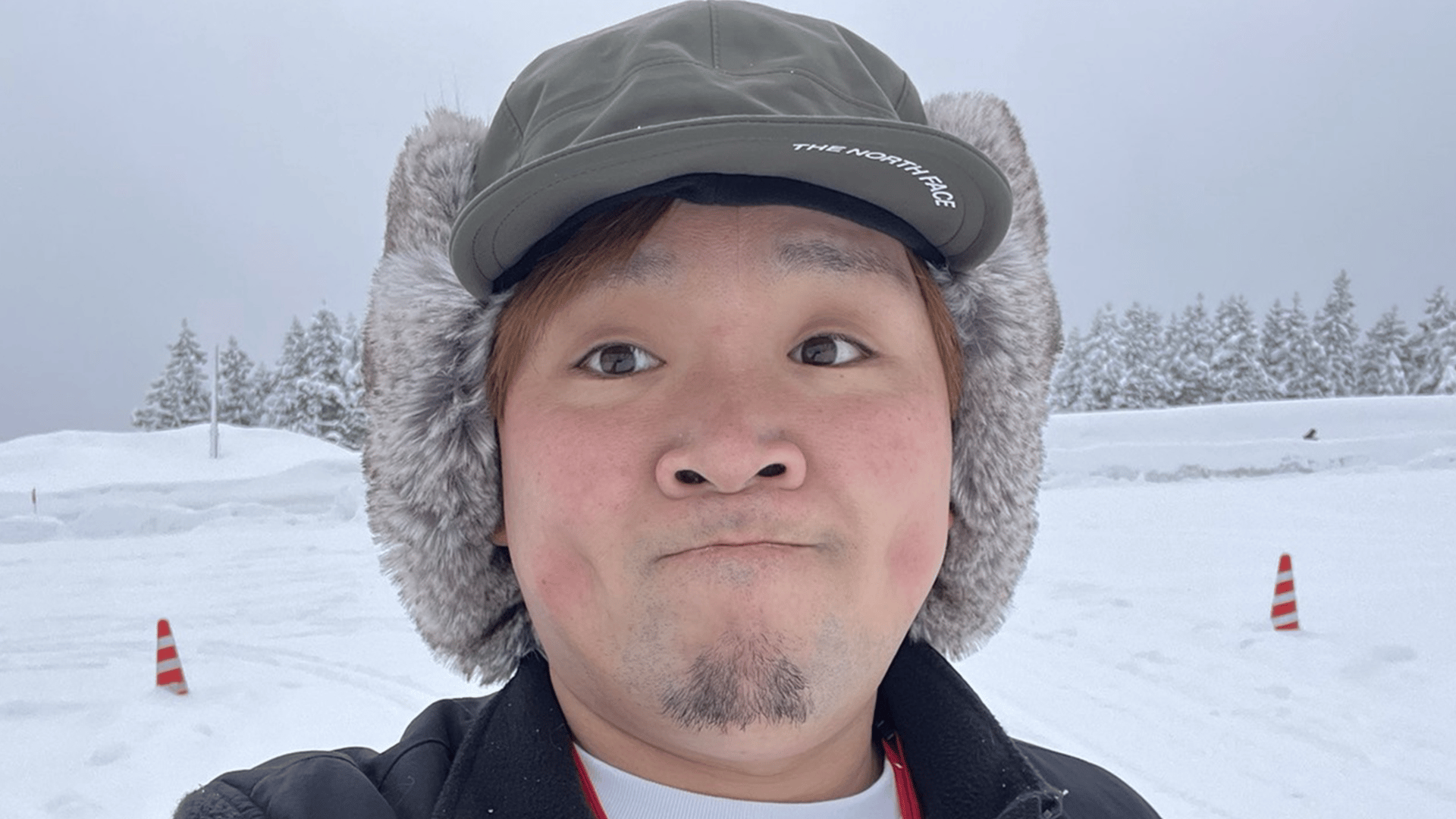  Foto zu “ステージ4のがんを公表”元芸人・マサ越前(35) 病状が悪化したことを報告「腫瘍が大きくなり 数も増えてしまって…」 - ABEMAエンタメ 