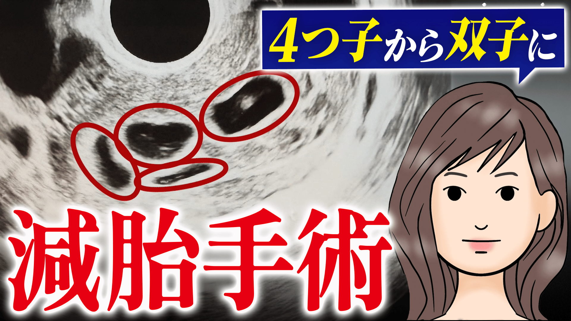 オウム真理教 麻原彰晃の三女・松本麗華さんの人生 - #アベプラ【平日