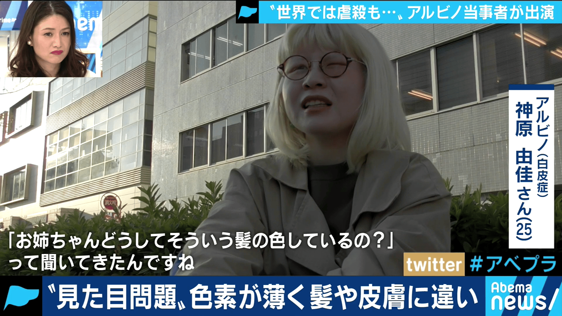 “見た目問題”は“見る目問題”!? 生まれつき色素が薄いアルビノ当事者の苦悩とは? (19/01/14)