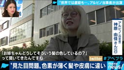 “見た目問題”は“見る目問題”!? 生まれつき色素が薄いアルビノ当事者の苦悩とは? (19/01/14)