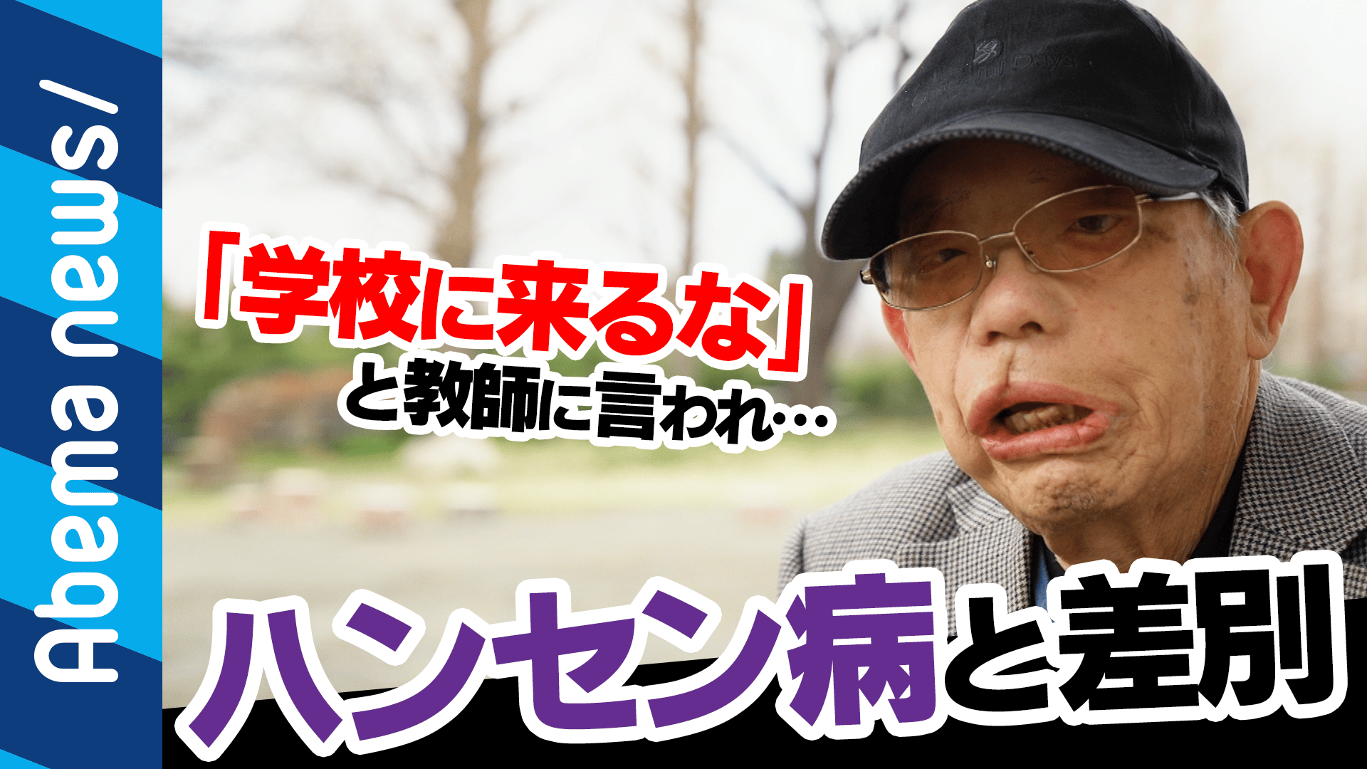 "絶対隔離"人権を無視される壮絶な暮らしとは?ハンセン病、回復者が当時の苦悩を語る(19/03/22)