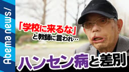"絶対隔離"人権を無視される壮絶な暮らしとは?ハンセン病、回復者が当時の苦悩を語る(19/03/22)