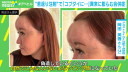 "若返り注射"で「おでこがコブダイに...」異常な膨らみ