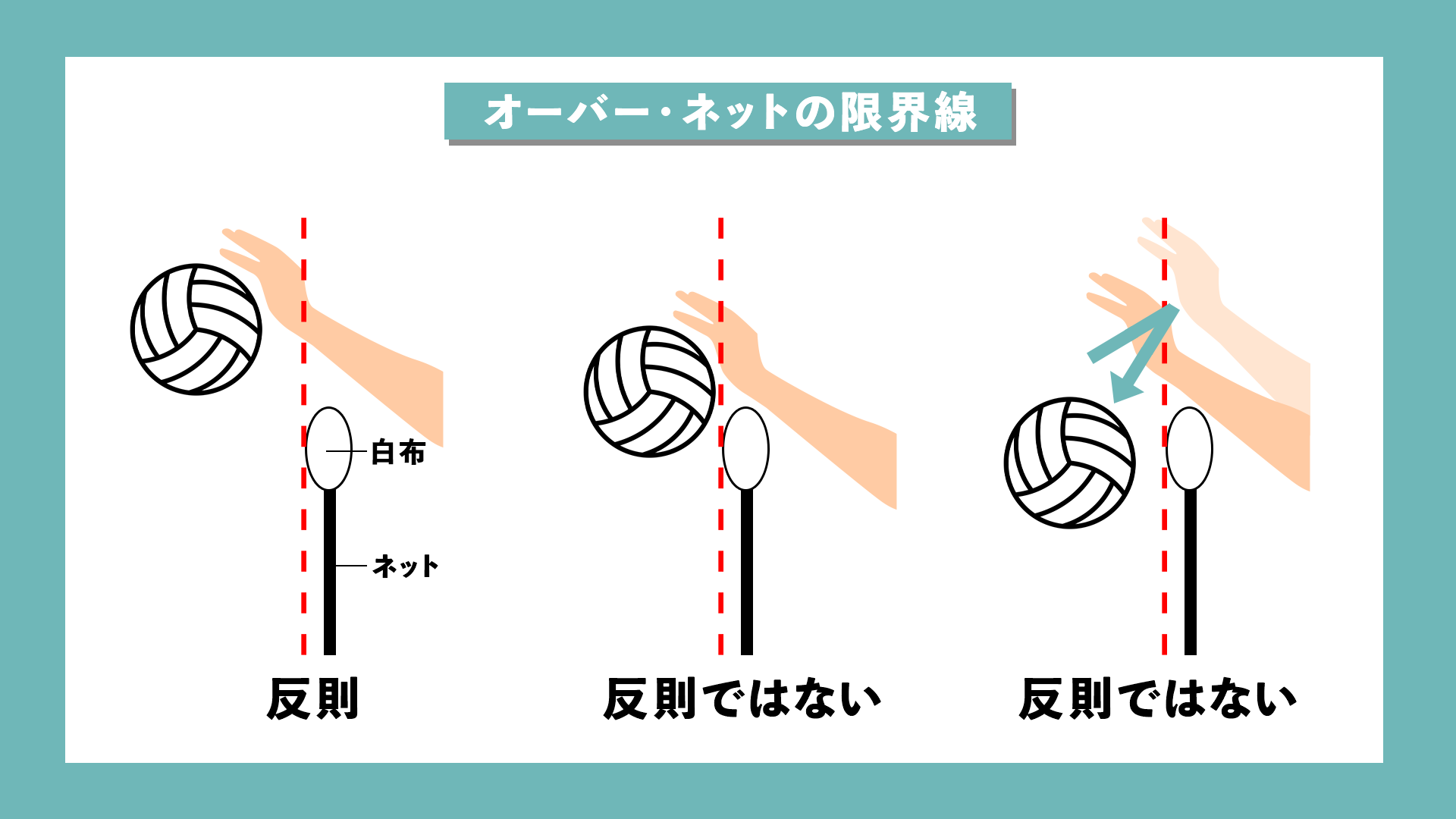 オーバーネット