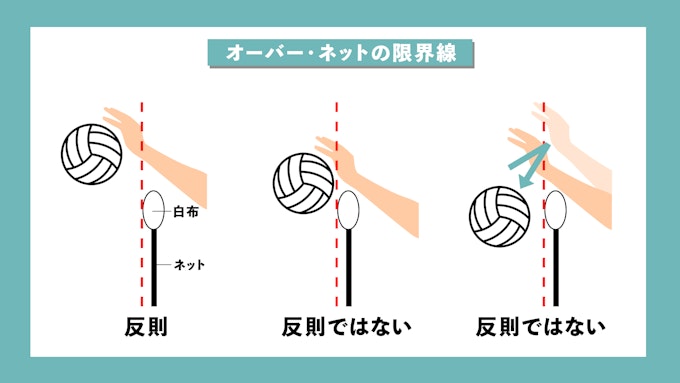 オーバーネット