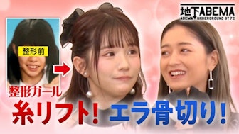 #13:「人生変わりました」別人?整形インフルエンサー