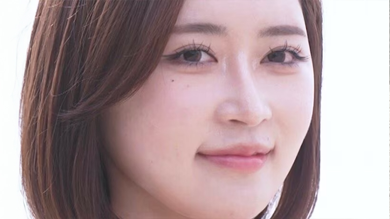 「全然違う！」整形総額1000万円の23歳美女のビフォーアフターに衝撃「綺麗な人やな」