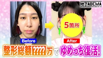 #38:芸能人の整形事情…なんでも答えますSP