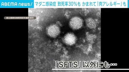 abema-news